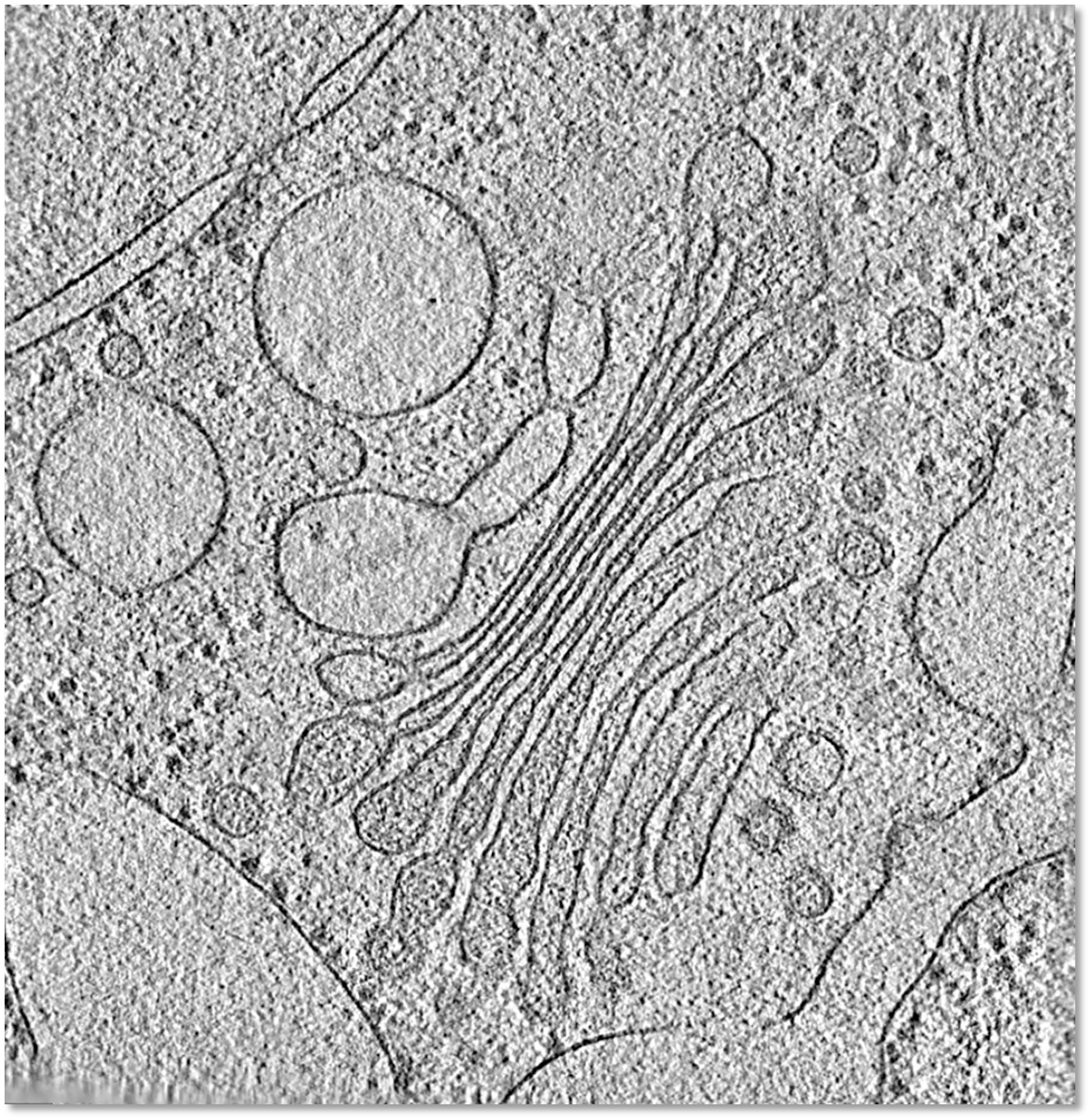 CryoETによる細胞内部のイメージ